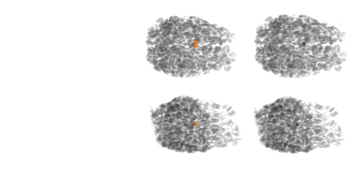 Stone detection in food