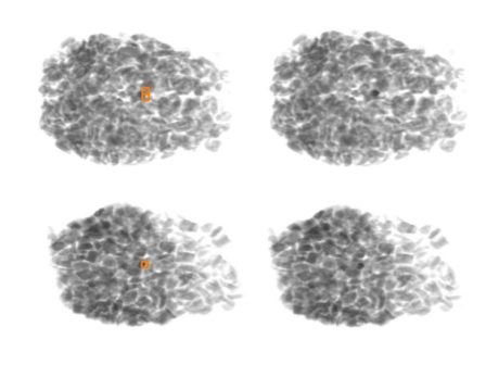 Stone detection in food